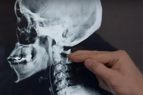 Best Chiropractic Care Near Me in Spring Hill, TN. Chiropractor For Pain Relief.